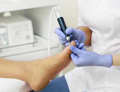 Professional hardware pedicure using electric machine.Patient on medical pedicure procedure, visiting podiatrist.Peeling feet with special electric device.Foot treatment in SPA salon.Podiatry clinic.